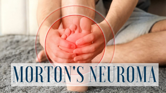 Could You Have a Morton’s Neuroma? Symptoms, Causes and Treatment!