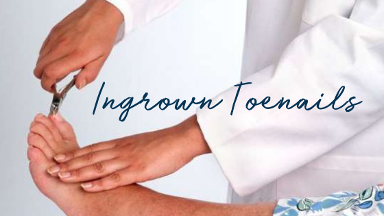 Ingrown Toenails – Symptoms and Solutions
